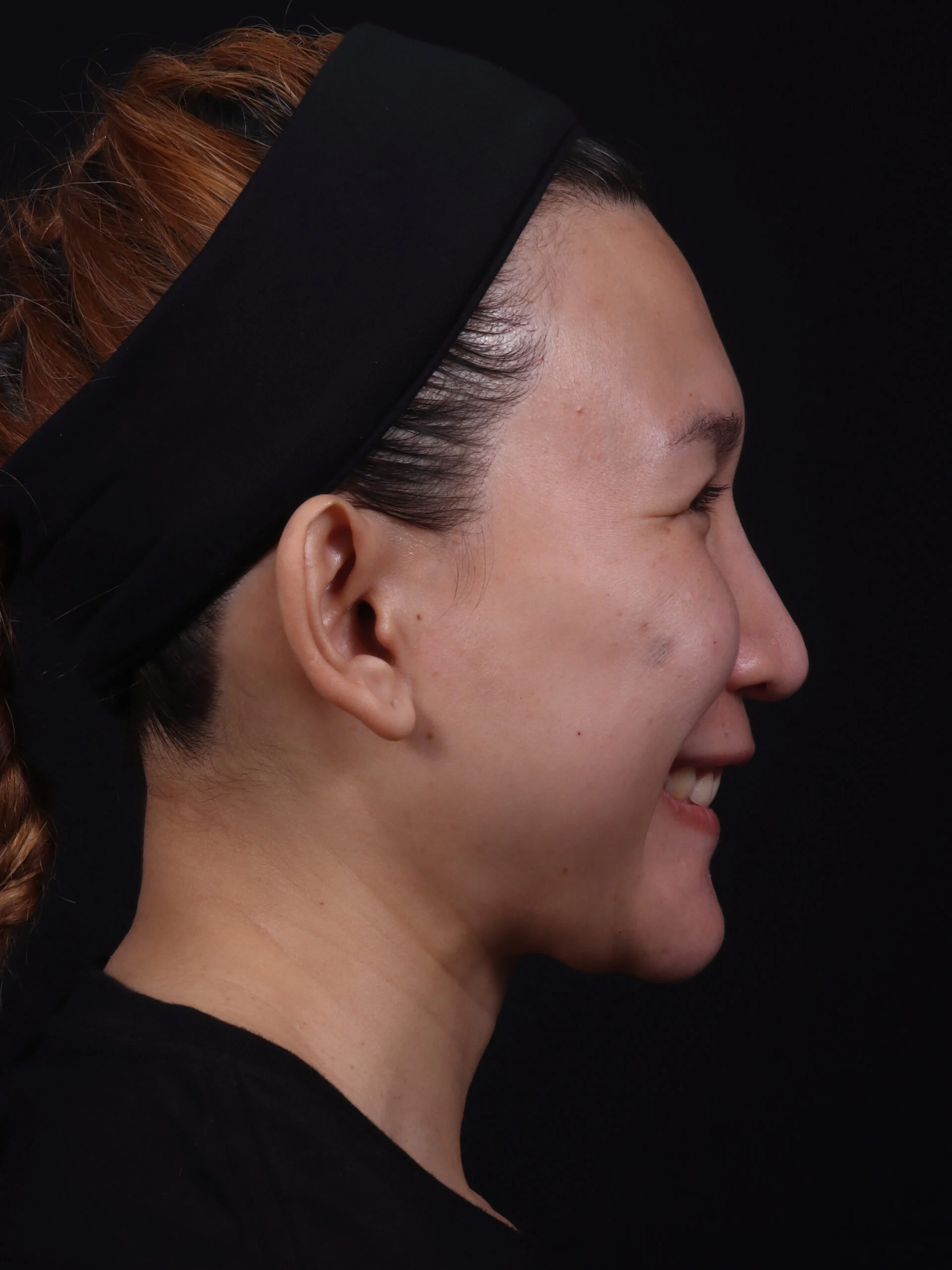 IMG_57239-001-scaled_web