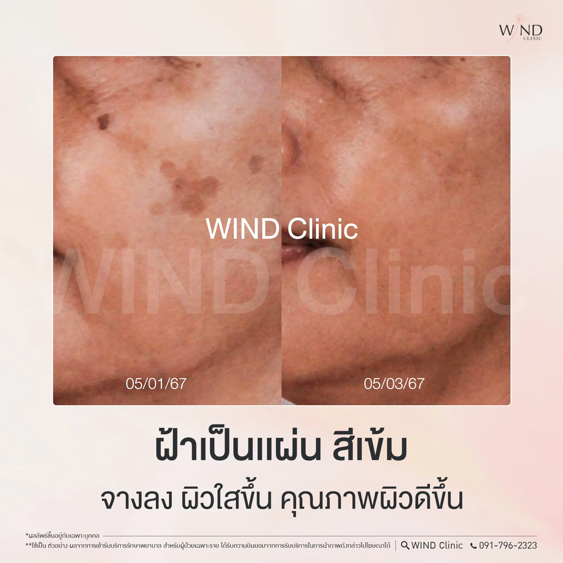 484809719_603332922706090_4209280588562184963_n