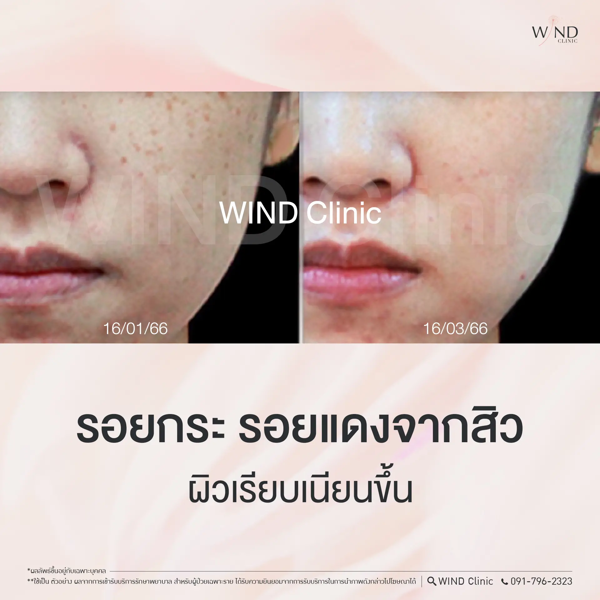 485079251_603332926039423_7564806171245134250_n