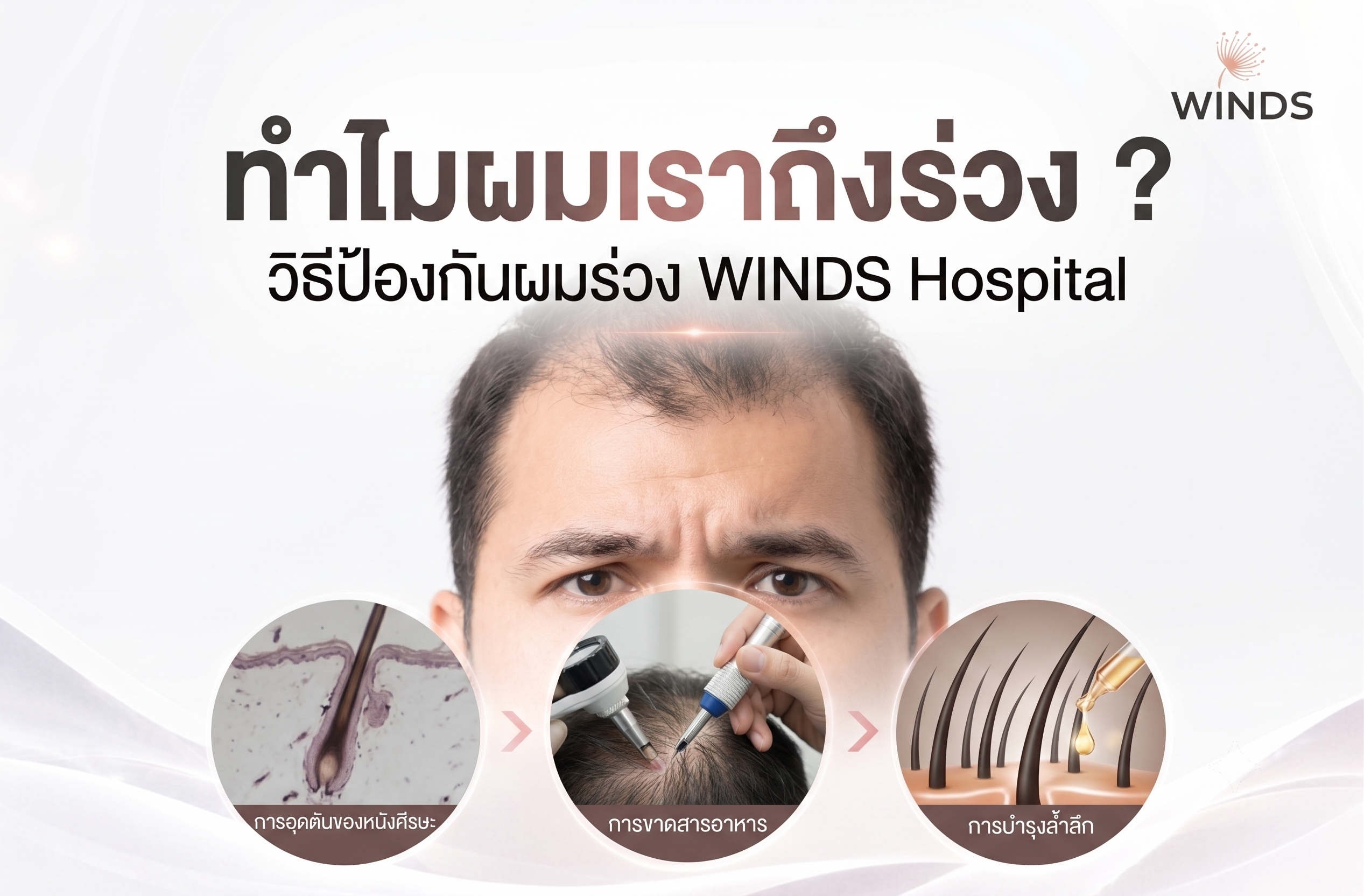 ทำไมผมเราถึงร่วง